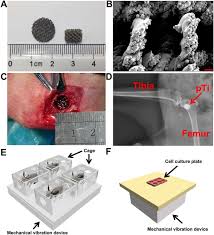 Not sure if it will set off the detectors at the airport, though. Effect Of Low Level Mechanical Vibration On Osteogenesis And Osseointegration Of Porous Titanium Implants In The Repair Of Long Bone Defects Scientific Reports