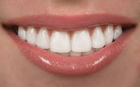 That means your veneered tooth, just like all of your teeth, should be. Veneers How Long Do They Last
