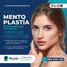 💎✨ Mentoplastia: Perfila tu rostro y resalta tu belleza Un mentón bien  definido es clave para un perfil armonioso y equilibrado. Si sientes que tu  mentón es pequeño, retraído o poco definido,