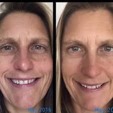 Rodan + Fields Consultant