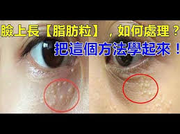 youtube health tips health keep fit