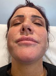 Facial aesthetics by Dr Charlotte Morton