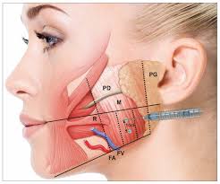 Image result for Botulinum Toxin Injection