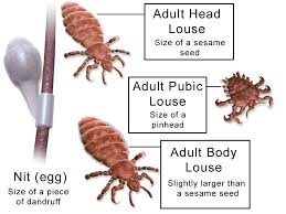 Image result for lice vs nits