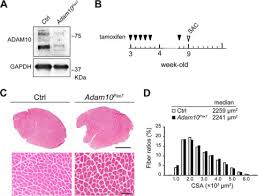 We did not find results for: A Disintegrin And Metalloprotease 10 Adam10 Is Indispensable For Maintenance Of The Muscle Satellite Cell Pool Journal Of Biological Chemistry