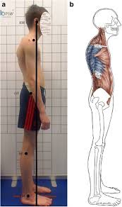 Can forward head posture be corrected? Rounded Shoulders Forward Head And Kyphosis Oh My How To Fix Your Asymmetries Waugh Personal Training