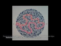 Membedakan warna kuning dan hijau termasuk. Tes Buta Warna Lengkap Penjelasannya Kesehatan Youtube