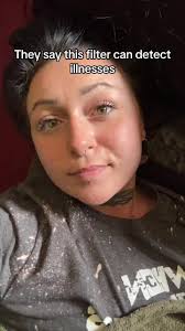 #prediction #glaucoma #filter #fyp #glaucomaawareness #visionimpaired  #oneeye