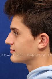 Facial Plastic Surgery Oklahoma City