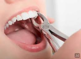 Tirupur Dental Center Dentists Book Appointment Online Dentists In Periyar Colony Tirupur Justdial Mother tongue interference would occur naturally in all language skills with some degree of relativity and in all linguistic components;