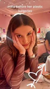 shocking || #milliebobbybrown #strangerthings #plasticsurgery