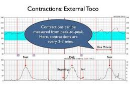 Qcom Fetal Heart Monitoring Uterine Contractions Fetal