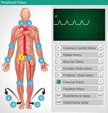 Peripheral Pulses