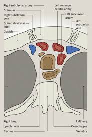 Bilateral posterior sternoclavicular joint dislocation is particularly uncommon. Disorders Of The Sternoclavicular Joint Sciencedirect