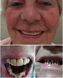 Lois Dental‎‏ (@‏‎loisdental‎‏) • صور ومقاطع فيديو على Instagram