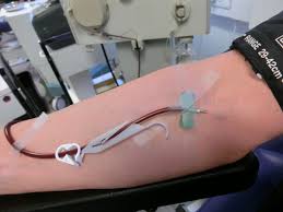 The good news is that you'll experience little pain and very few side effects, but there are many real positives for you. File Blood Plasma Donation 3653 Jpg Wikimedia Commons
