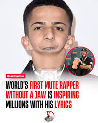 Nightfam! What if I told you the most inspiring rapper in America can't  speak a single word? Born without a jaw, doctors said Isaiah Acosta  wouldn't survive 24 hours. But not only