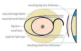 corrective lens wikipedia