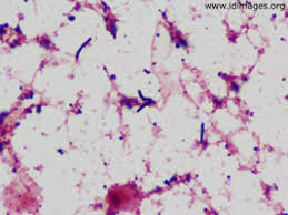 Image result for Rhodococcus equi