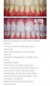 Weisse Zahne Mix 1 Teeloffel Backpulver 1 2 Teeloffel Wasserstoffperoxid 1 2 Teeloffel Was Hydrogen Peroxide Baking Soda Brushing Teeth