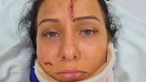 Fundraiser by Jaclyn Smith : Help Support a Family after a Severe Car Crash.