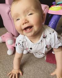 Yes , we all carry the BPES gene !