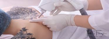 Maybe you would like to learn more about one of these? 1 Day Master Tattoo Removal Course In Dubai Uae By Paris Faraji