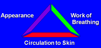Image result for Pediatric Assessment Triangle
