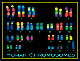 Human Cells Have 46 Chromosomes If There Is An Extra Copy Or A Missing Copy This Will Severely Inhibit The Embryo S Abil Down Syndrome Human Genome Syndrome