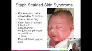 Pediatric Board Review Videos