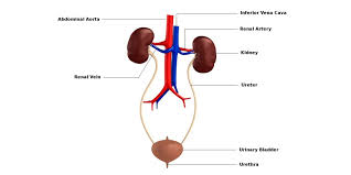 Patients with lymphoma and leukemia are susceptible to aki from a variety of causes that can be broadly divided into those directly related to the cancer and those. Kidney Stones Treatment Surgery Symptoms Causes Rg Hospital