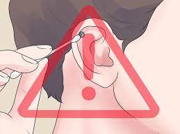 How To Heal Cartilage Piercing Bumps Piercing Bump Cartilage Piercing Piercing