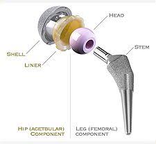 Check spelling or type a new query. Pin On Hip Replacement