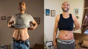 If you have a fupa and want to get rid of it, do this. After Huge Weight Loss Sagging Skin Remains
