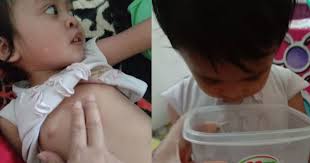 Batuk produktif adalah batuk yang berdahak. Teknik Urut Secara Bulatan Di Dada Bantu Legakan Anak Batuk Dan Berkahak Pa Ma