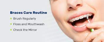 Consider using a floss threader to help make cleaning. Braces Tips Care Routine Care For Your Braces
