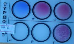 Maybe you would like to learn more about one of these? Widal Test Principle Procedure Results Limitation Microbe Online