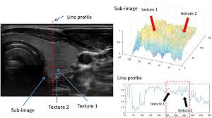 To make use of the contents of a first aid kit c. Parametrical Modelling For Texture Characterization A Novel Approach Applied To Ultrasound Thyroid Segmentation