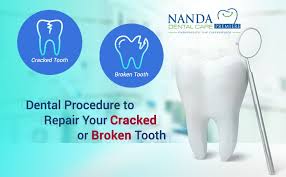 Dental Procedure To Repair Your Cracked Or Broken Tooth Broken Tooth Dental Procedures Cracked Tooth