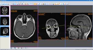 You can download free dicom software. Sante Dicom Viewer Pro Santesoft Ltd