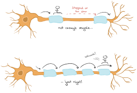 What Is Multiple Sclerosis Article Khan Academy