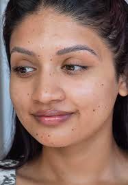 Feet? Sure. But my hoohaa too💀?! Past me was definitely someone’s  favorite. 😭😂 #moles #beautymark #beautymarks #molemyth #facemoles