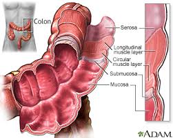 Metastatic colon cancer might cause symptoms in your liver, lungs, bones or abdomen. Colon Cancer Information Mount Sinai New York
