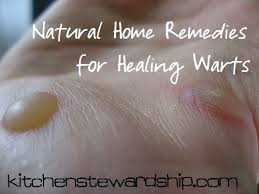 3 Step Home Remedy For Warts Kitchen Stewardship Home Remedies For Warts Warts Remedy Natural Home Remedies