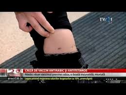 Criză De Vaccin Antirabic Si Antitetanos Youtube