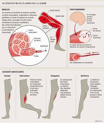 Generalites correpondent aux muscles qui occupent le segment fémoral du membre on vous recommande de boire avant, pendant et après votre effort. Le Claquage Fait Mal Mais Guerit Bien Avec Du Repos Planete Sante