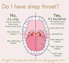 Strep Throat Diagram Strep Throat Remedies Throat Remedies Strep Throat