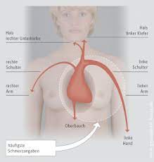 Koronare Herzkrankheit Khk Und Stabile Angina Pectoris