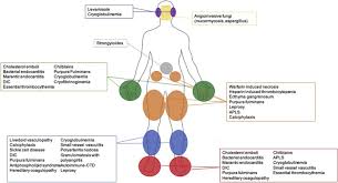 The differential diagnosis of purpura in children is also reviewed separately. Retiform Purpura A Diagnostic Approach Journal Of The American Academy Of Dermatology