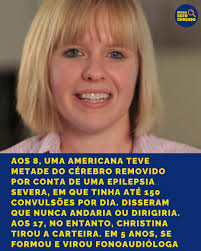 Cameron Mott, dos EUA, foi diagnosticada aos 3 anos com uma forma rara de  epilepsia chamada síndrome de Rasmussen. Aos 8, passou por uma  hemisferectomia — cirurgia em que metade do cérebro